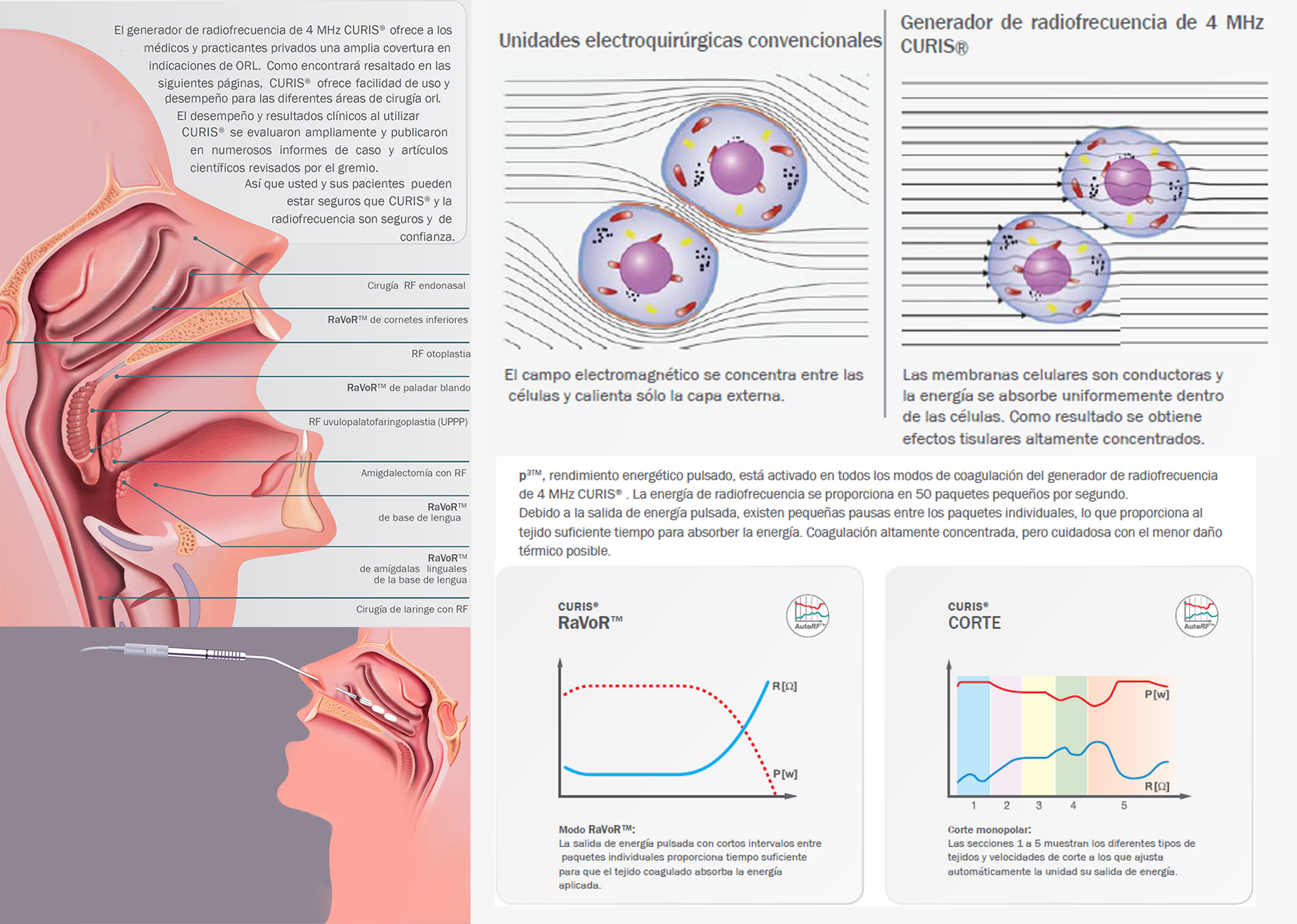 servicio de radiofrecuencia